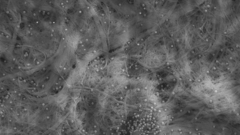 Mikromuovia kuvattuna nanoselluloosan 